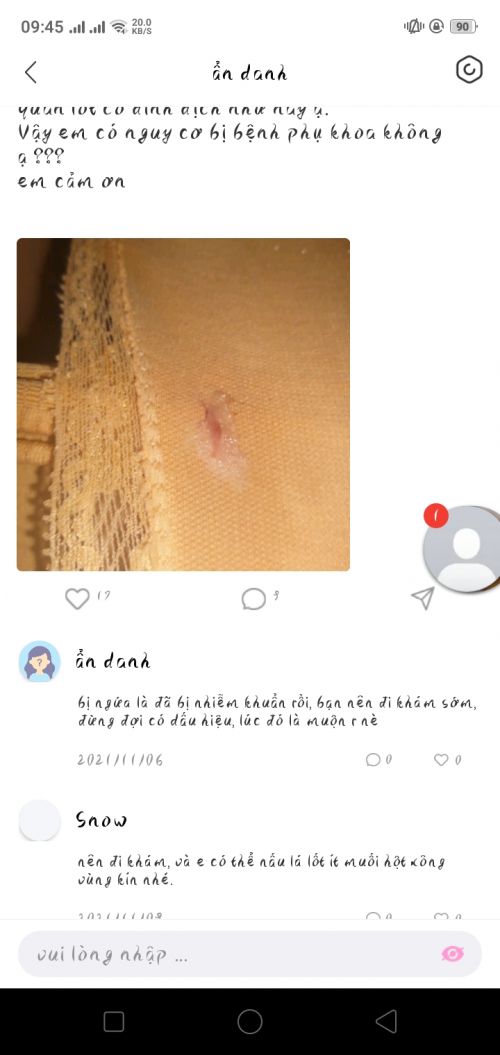 Ảnh