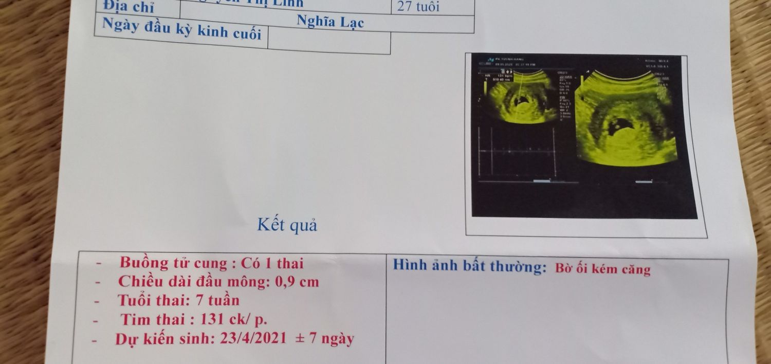 Tim Thai Yếu Tuần Thứ 6: Nguyên Nhân, Triệu Chứng Và Cách Xử Lý Hiệu Quả