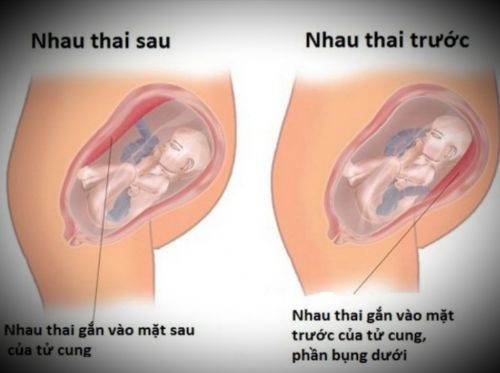 Ảnh