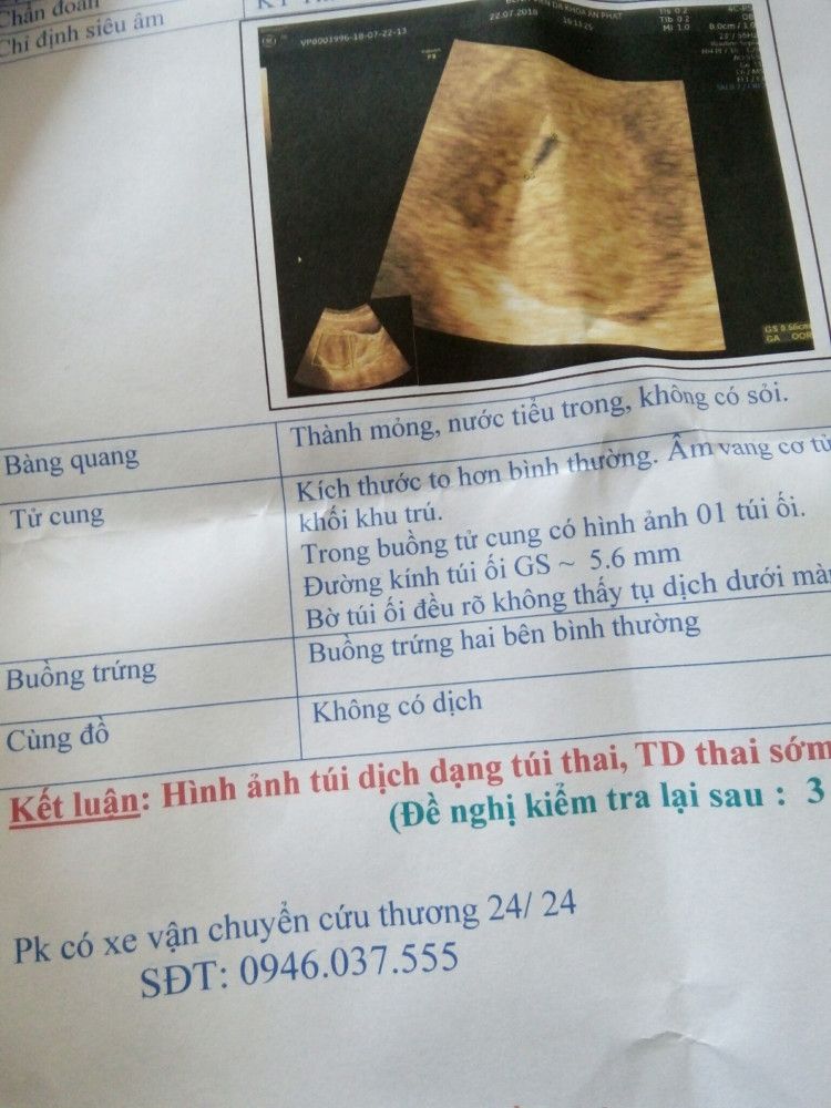 Trễ kinh 20 ngày siêu âm không thấy thai: Nguyên nhân, triệu chứng và hướng dẫn chăm sóc